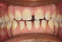 Close Up Photos